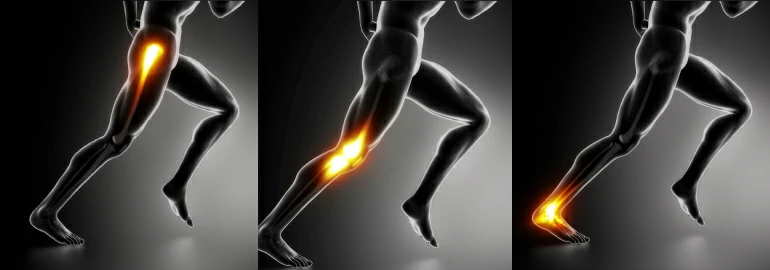 3 Tips to Prevent Sports Injuries